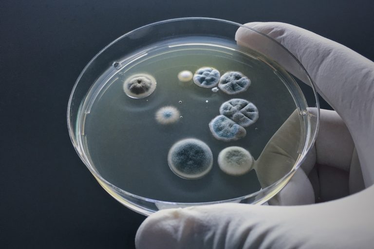 How to Reduce Mold Allergies Dr. Amy B, Schiffman, MD